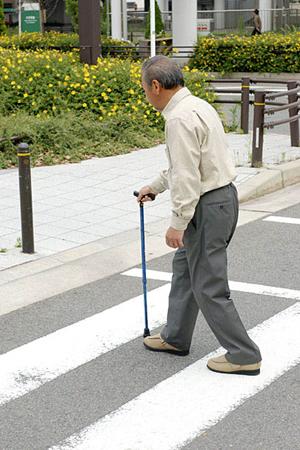 東京のマウスピース型で治療する矯正歯科